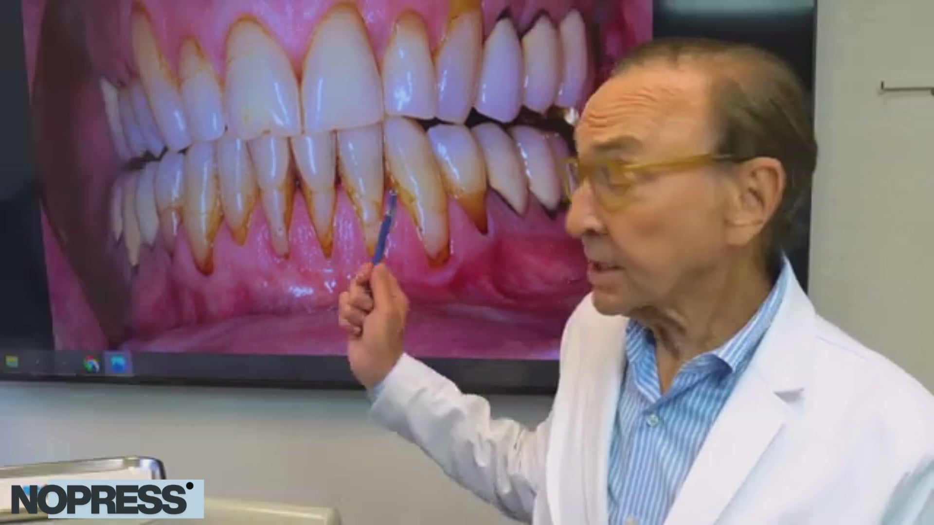 Charger la vidéo : 